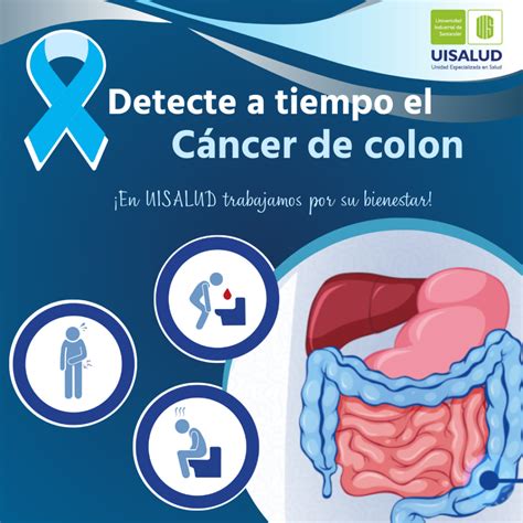 La Detección Temprana Del Cáncer De Colon Salva Vidas Comunicaciones Uis