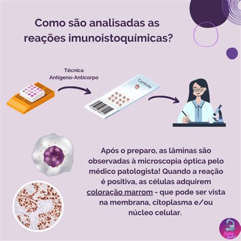 Exame Imuno-histoquímico Positivo O Que Significa - Carcinomas Mamários: Imunoistoquímica – PathoLovers