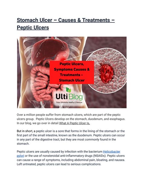 Stomach Ulcer – Causes & Treatments – Peptic Ulcers by UltiBlog - Issuu