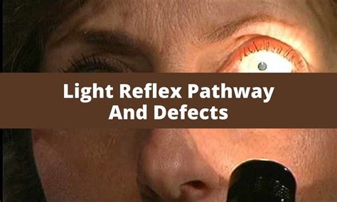 Light Reflex Pathway And Defects | Medical Junction