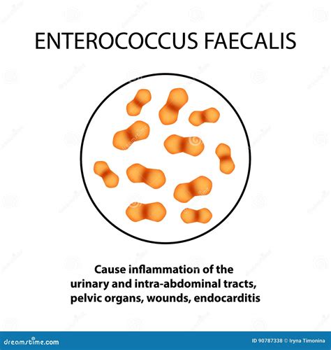 Enterococcus Faecalis. Pathogenic Flora. the Bacterium Causes Intestinal Diseases. Infographics ...