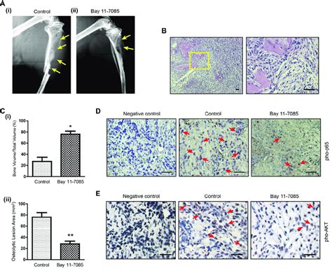 Bay Represses Intraosseous Tumor Growth A X Day Radiography