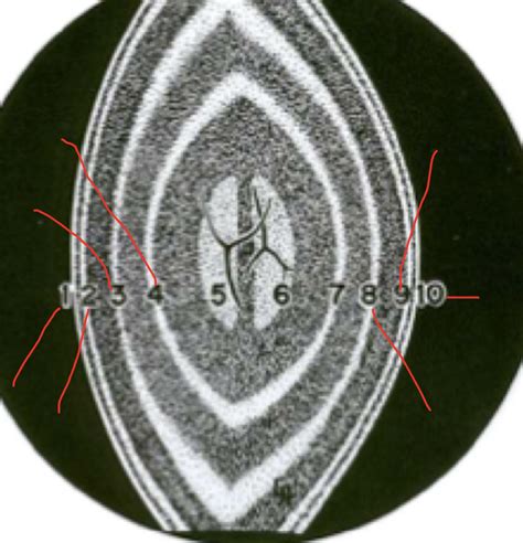 Crystalline Lens Anatomy Diagram | Quizlet