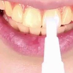 10 Ideias De Maria Ramos Branqueador De Dentes Branqueamento Dental