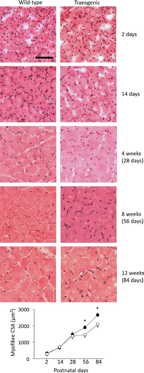 Tibialis Anterior Muscles Of Transgenic Mice Exhibit Myofiber Atrophy