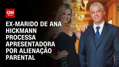 Ex Marido De Ana Hickmann Processa Apresentadora Por Aliena O Parental