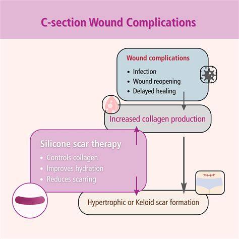 Types of C-section stitches and how they affect your scar recovery