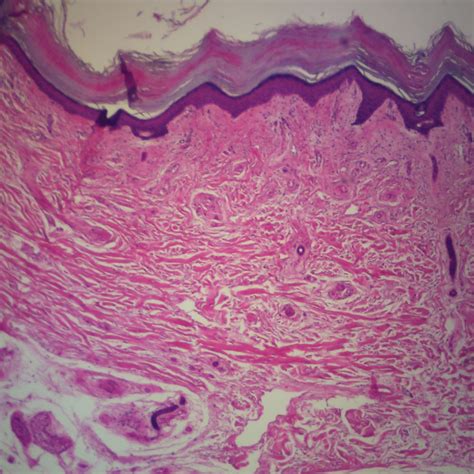 Prepared Microscope Slide, Human Skin, Non-pigmented Normal, H&E ...