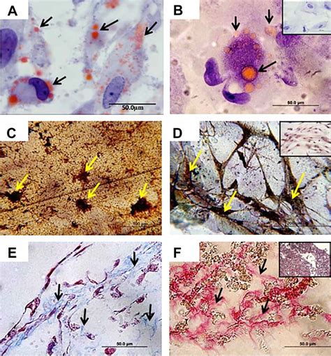 Differentiation And Tumorigenic Formation In Nude Mice Assay