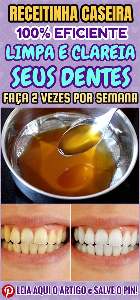 Veja Como Clarear Os Dentes Em Casa Usando Vinagre De Ma Clarear