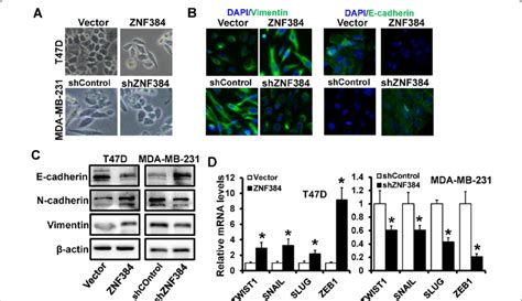 ZNF384 Induces An EMT Like Phenotype In Breast Cancer Cells A