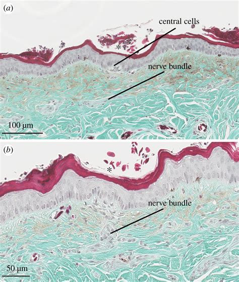 Light Micrographs Of A Transverse Section Of Cephalic Skin Nasal