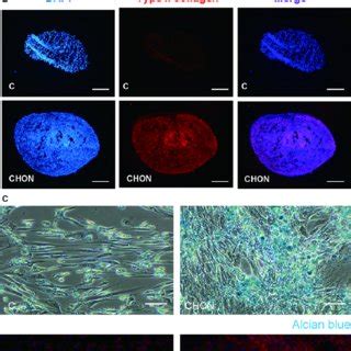 Histone acetylation and deactylation. Histone acetyltransferase (HATs ... 