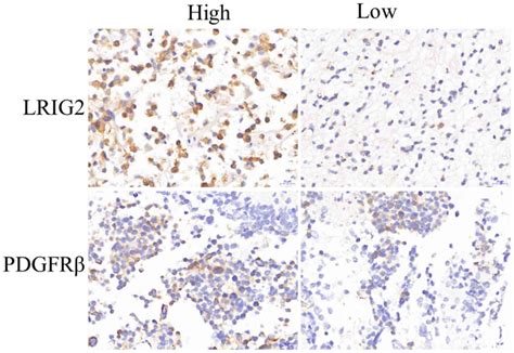 Lrig2 Promotes The Proliferation And Cell Cycle Progression Of