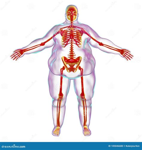 Obesity Problem Conceptual Image Stock Illustration - Illustration of