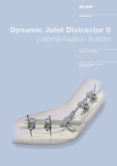 Dynamic Joint Distractor II External Fixation System Stryker