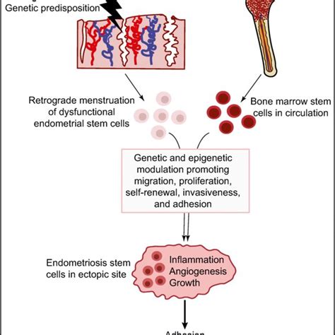 Proposed Stem Cell Concept For The Development Of Endometriosis