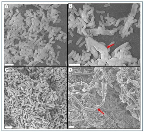 Pseudomonas Aeruginosa Morphology And Arrangement