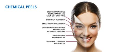 Chemical Peel Treatment Cost In India View Cost