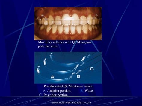 Newer Wires Certified Fixed Orthodontic Courses By Indian Dental Aca