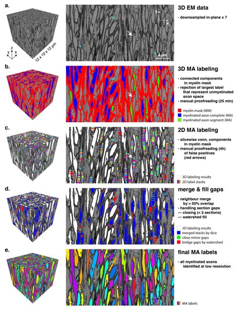 Procedure for identification of myelinated axons (MA). The left and ...