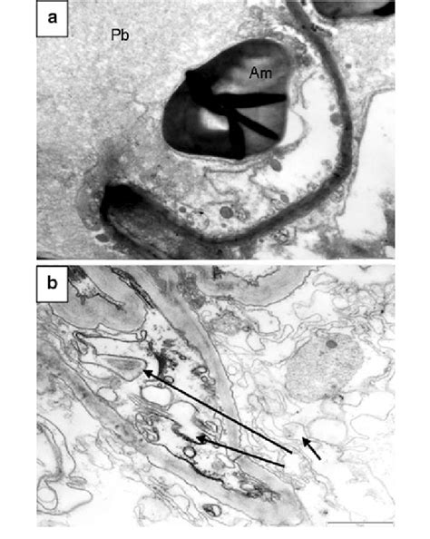 cellular structure  ultrastructure   megagametophyte  months