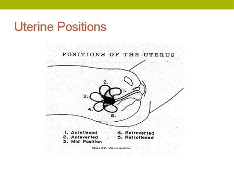 Long Acting Reversible Contraceptives The Basics Objectives Explain