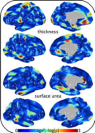 Significance Of Sex Covariance In Cortical Thickness And Surface Area Download Scientific