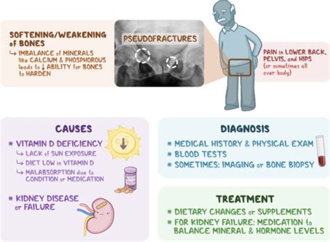 Endocrine Osteomalacia Flashcards Quizlet