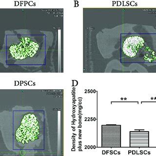 Micro Ct Images Of New Bone Formation In Sediment From Cultures Of