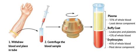 Platelet Rich Plasma Prp Rejuvie Aesthetic And Dermatology Bali