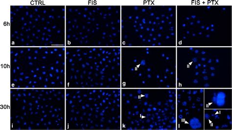 The assessment of the nuclear morphology using DAPI staining and ...