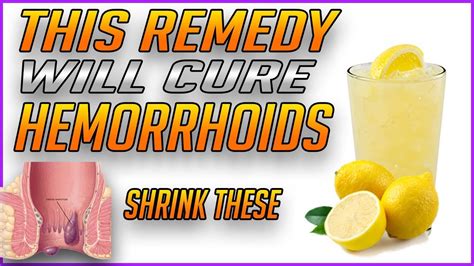 How To Get Rid Of Hemorrhoids Fast And Naturally Best Remedy How To Heal And Cure