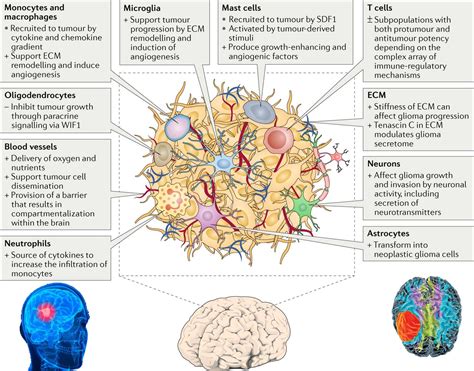 Glioblastoma : new targets for treatment with brain cancer cells ...