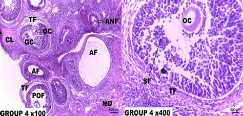 Photomicrograph Of The Rat Ovary Tissue Section Of Group 4 H And E