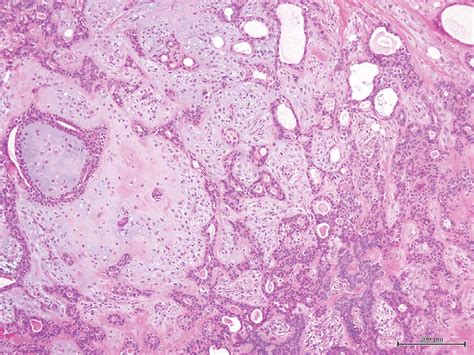 Histopathologic View Hematoxylin And Eosin Histopathological