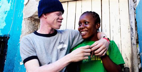 Albinos Living In Tanzania Are Hunted Down And Mutilated, Sometimes By ...