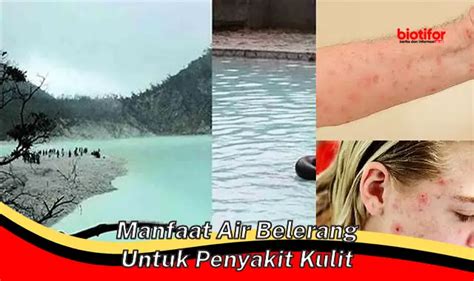 Temukan Manfaat Air Belerang Untuk Penyakit Kulit Yang Jarang Diketahui