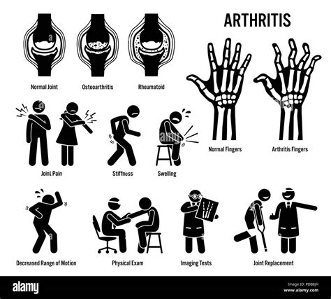 Arthritis Joint Pain And Joint Disease Icons Pictograms Depict