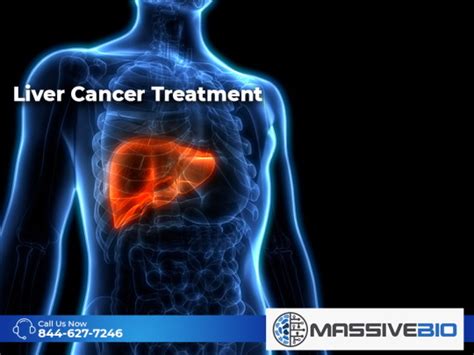 Liver Cancer Treatment