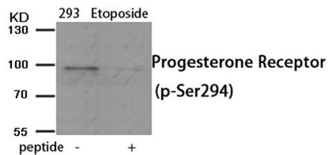 Progesterone Receptor Phospho Ser294 Antibody Cat No 80 039 Prosci