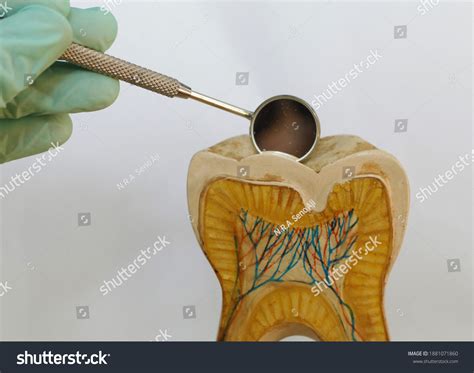 Human Dental Anatomy Model Educational Purposes Stock Photo 1881071860 | Shutterstock