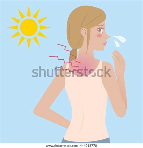 Young Female Bad Sunburn On Her Stock Vector Royalty Free 444018778