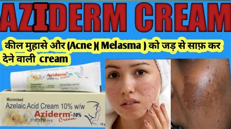 Aziderm Cream Aziderm Cream Review Azelaic Acid Aziderm 10 Gel Aziderm Cream Use Youtube