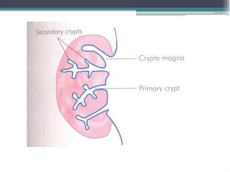 Diseases Of Tonsils And Adenoids Ppt