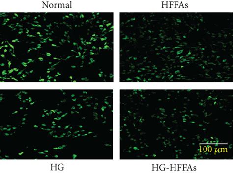 The Influence Of Hg Hffas On Cmecs A The Representative Mitral Flow