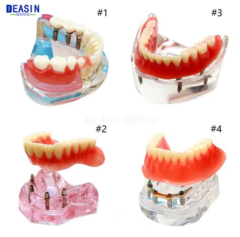 Di Implant DemonstrationTeeth Retim Modeli Ve Di Hekimi Renci Renme