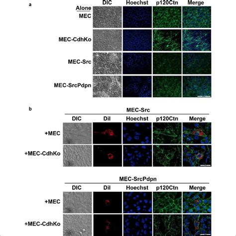 Nontransformed Cells Stabilize P Catenin Expression In Adjacent Src