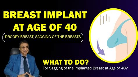 Breast Drooping Sagging With Aging How To Fix Breast Ptosis Breast