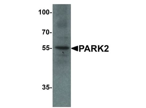 Park2 Antibody 600 401 Dj9 Rockland